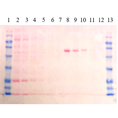 Ponceau s stain